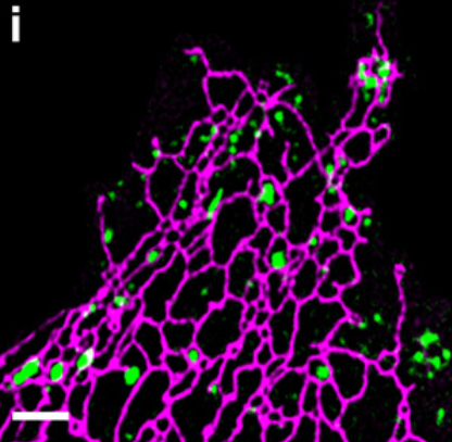 mmexport8337d3dfd5b0b266264461278162d154.png